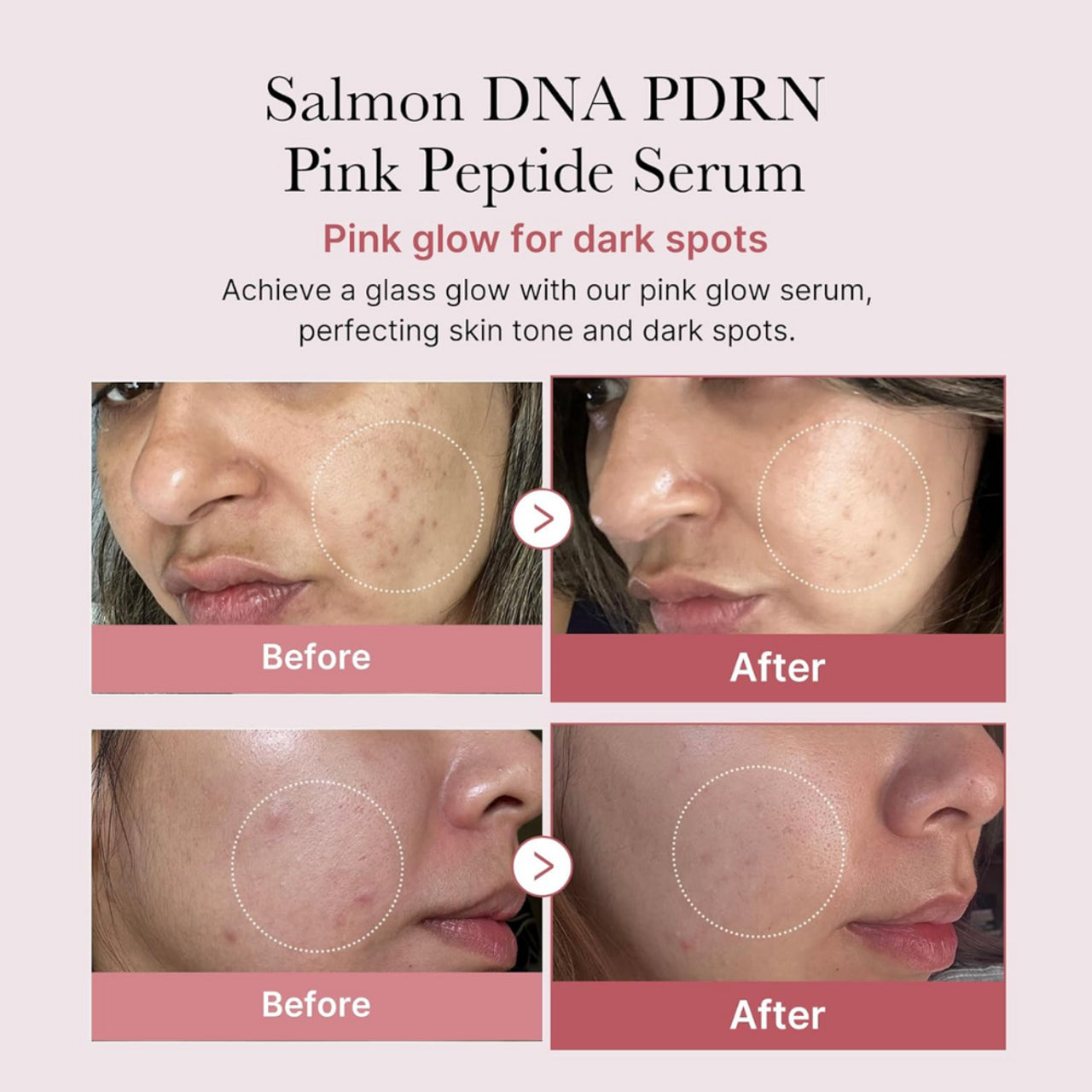 Medicube – PDRN Pink Peptide Serum (30ml)