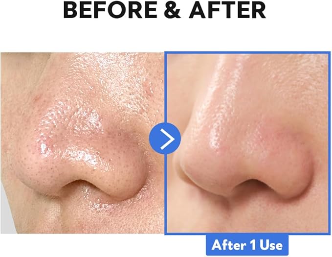 TIRTIR – Hydro Boost Enzyme Cleansing Balm (120ml)